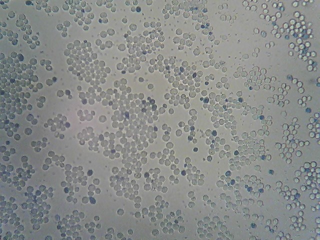 Kleuren dode cellen tbv microscopisch onderzoek - Brouwproces - Forum ...