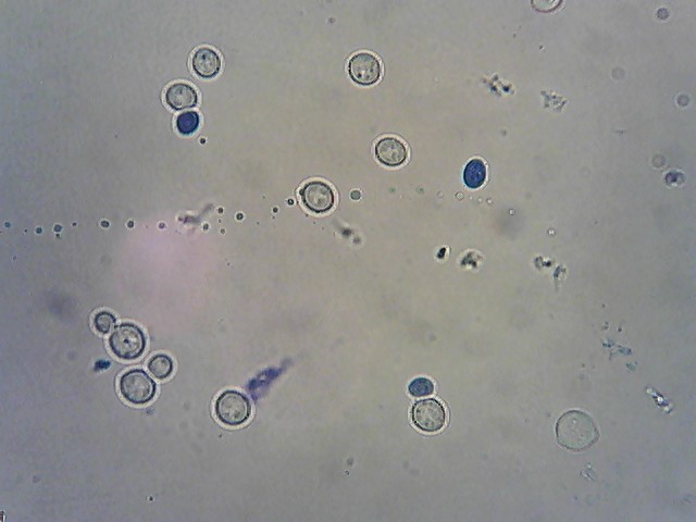 Kleuren dode cellen tbv microscopisch onderzoek - Brouwproces - Forum ...